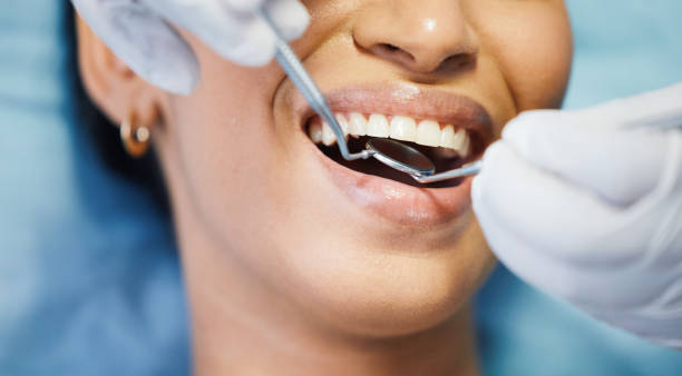 Best Emergency Dental Care for Sports Injuries in Bradford, TN